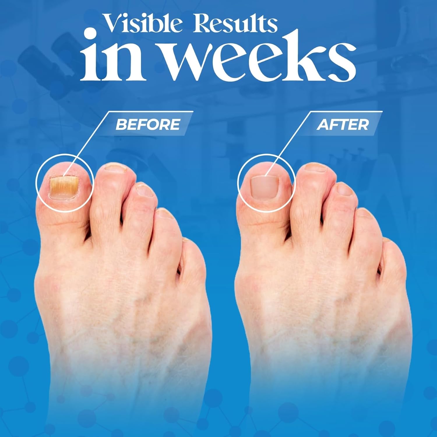 Aromasong Tea Tree Foot Soak with Magnesium Flakes and Dead Sea Foot Soaking Salts - Pedicure Tea Tree oil foot Soak for Dry Cracked Feet-Athlete's Callus Remover- Eliminates Odor- Packaging may vary - Image 2