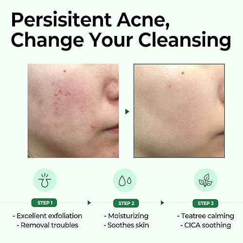 Miniatura 3 de SOME BY MI AHA BHA PHA 30 Days Miracle Cleansing Bar - 3.73 onzas, 3.74 oz - Jabón exfoliante suave para limpieza corporal - Efecto hidratante,