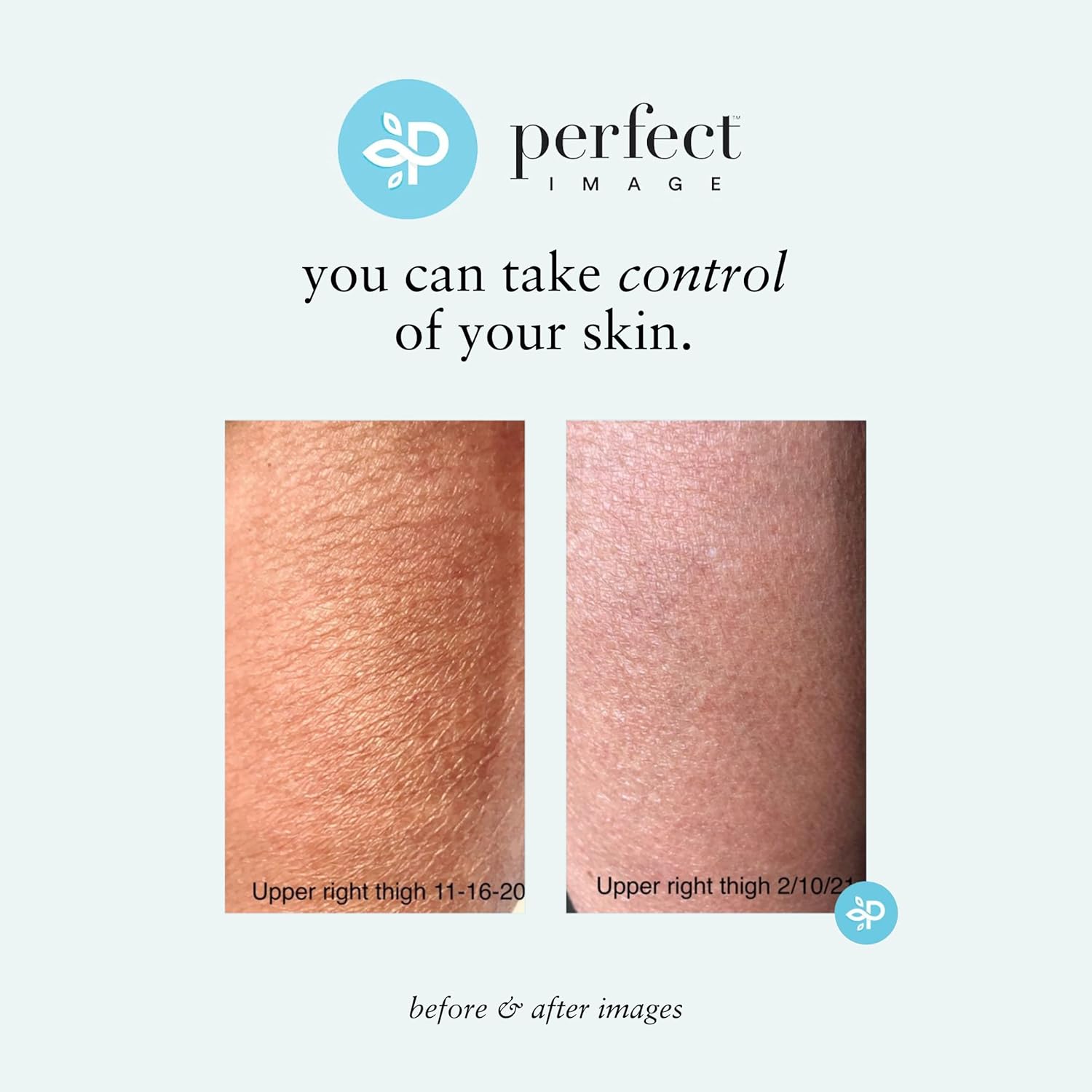 Perfect Image Gly + Sal Exfoliating Body Lotion, 8% Glycolic Acid and 2% Salicylic Acid Lotion Enhanced with Green Tea, Papaya, Bearberry, Licorice and Amino Complex - Image 9