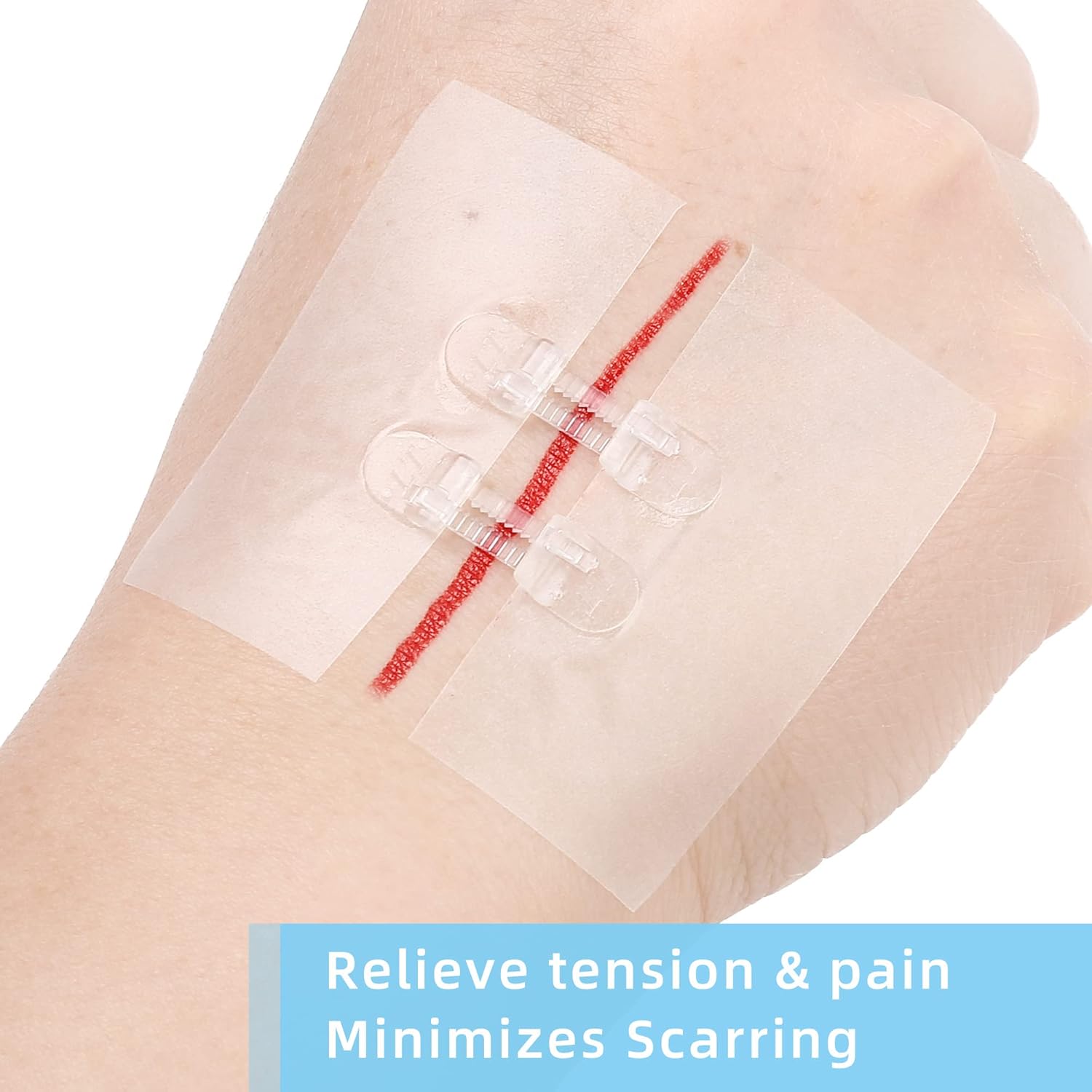 LotFancy Emergency Wound Closures, 4-Count, First Aid Supplies, Medical Butterfly Bandaids, Surgical Sutures Laceration Repair Kit with Accessories, Sterile, Latex-Free (Pack of 2)