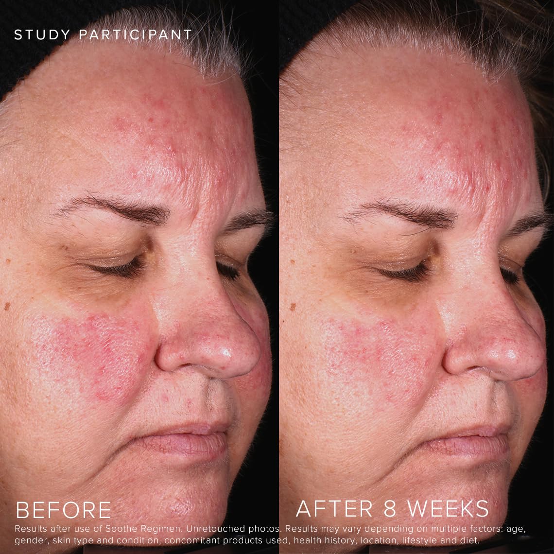 Rodan + Fields Soothe Calming Gel Cleanser | 125 ml | Dry & Sensitive Skin | Moisturizing & Hydrating Skincare - Image 4