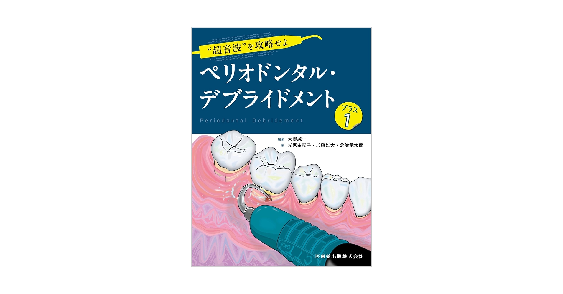 はじめての全部床義歯 根管洗浄 根管充塡 ペリオドンタルデブライドメント はじめての全部床義歯 根管洗浄 根管充塡 ペリオドンタルデ