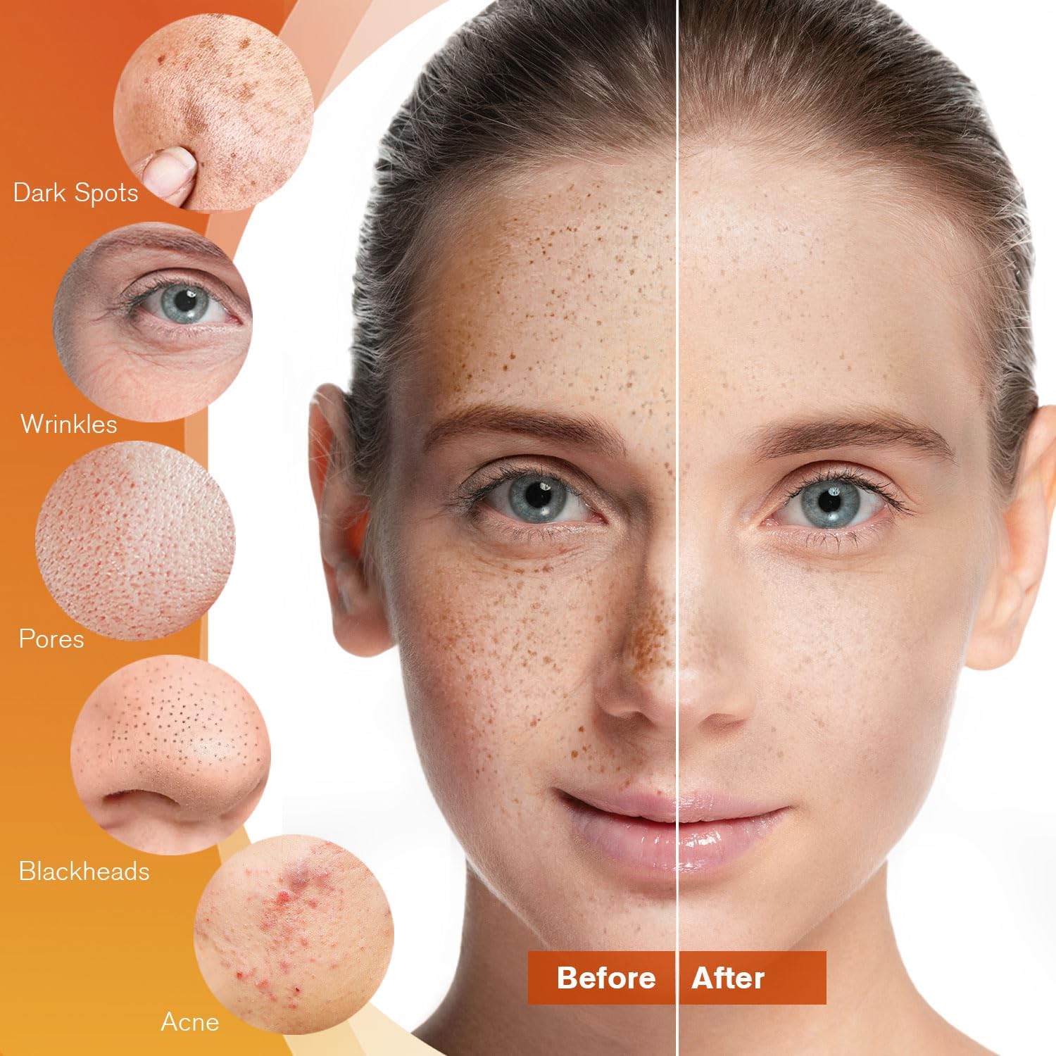 Kojic Acid Soap Dark Spot Remover: 3 Pack Turmeric Soap Bars with Vitamin C/Retinol/Collagen/Hyaluronic Acid - Moisturizing for Body & Face/Acne Scars/Melasma/Uneven Skin Tone - Image 3