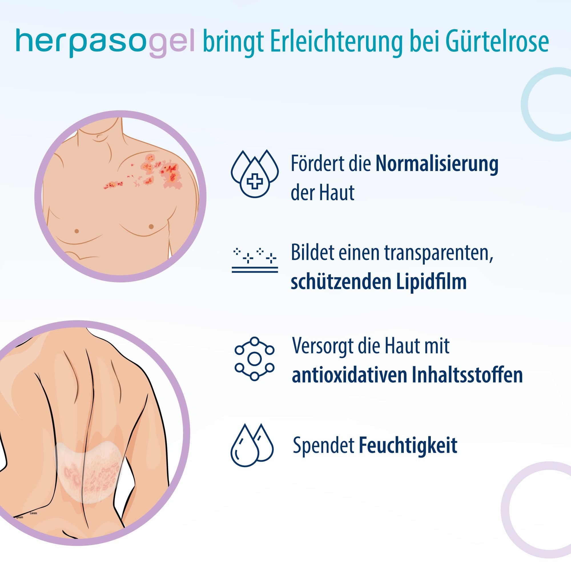 Herpasogel bei Gürtelrose | Fördert die Normalisierung der Haut bei Herpes zoster | Reich an natürlichen funktionellen Inhaltsstoffen