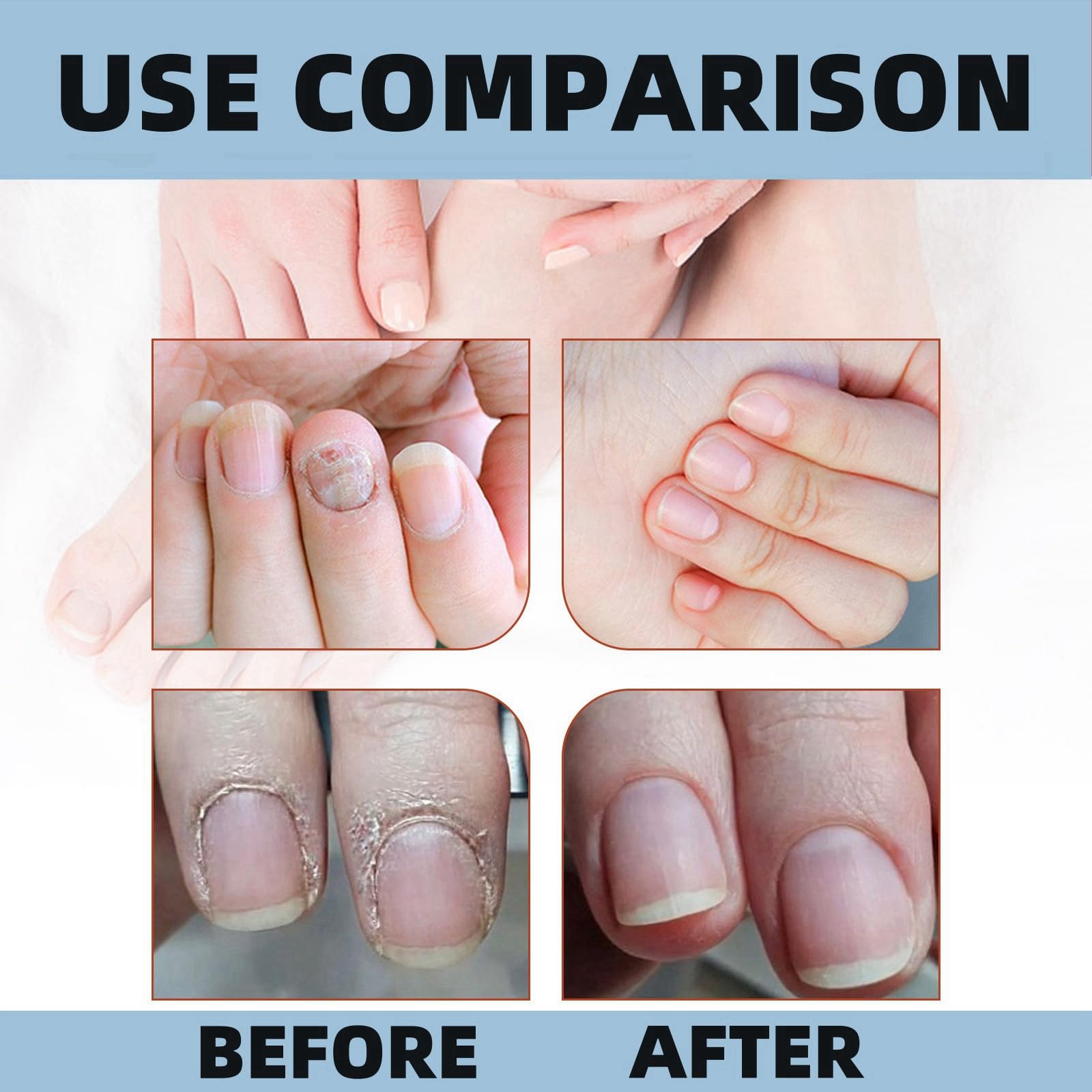 BigyQiu Nail Growth & Repair Serum - Strengthens & Hardens Damaged Nails, Blue, 15 ml (Pack of 1) - Image 2