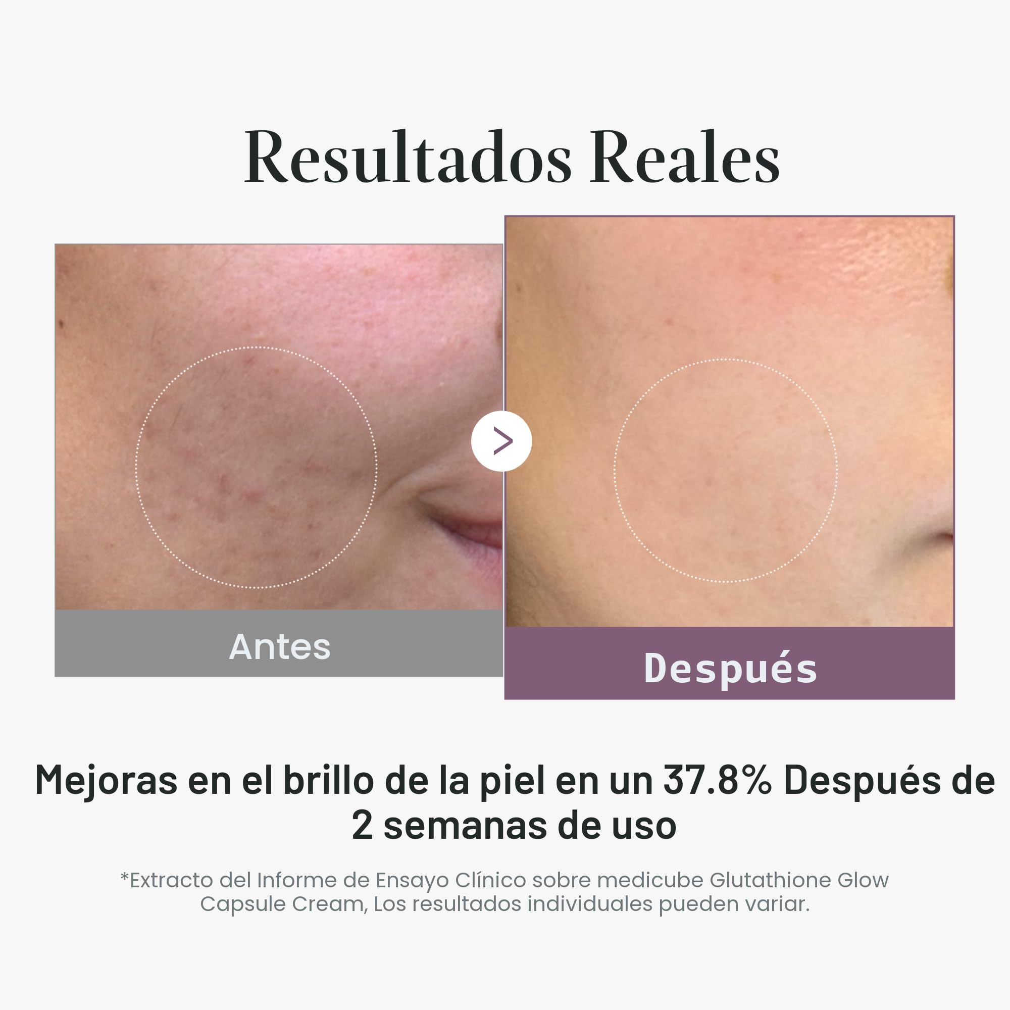 glutathione antes y después Thailand Best Seller Glutathione: Top Products & Market Insights