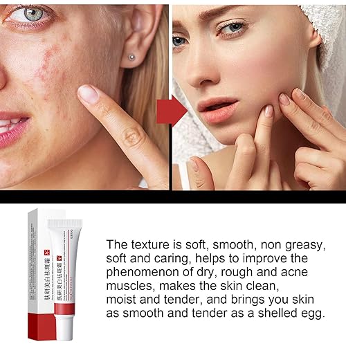 Miniatura 3 de Crema para manchas oscuras en la cara, cremas para Quitar Manchas de La Cara, crema para Las Manchas de La Cara, crema para limpiar la cara Elimina