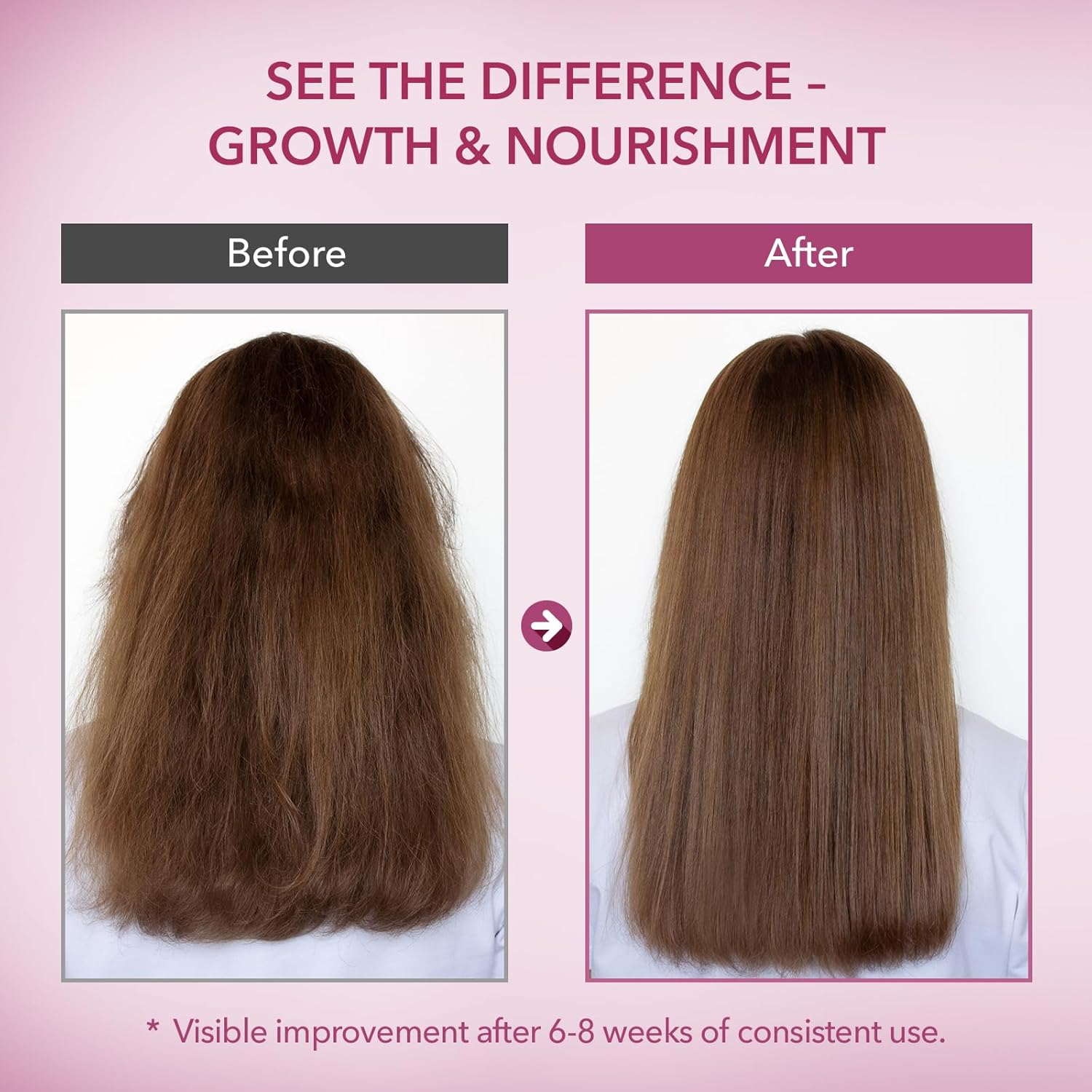 Onion & Rosemary Hair Growth Conditioner: Biotin Infused Nourishing Formula for Thinning, Dry, Breakage & Damaged Hair – Moisturizing & Strengthening Conditioner for Women and Men - 16.9 Fl Oz - Image 4