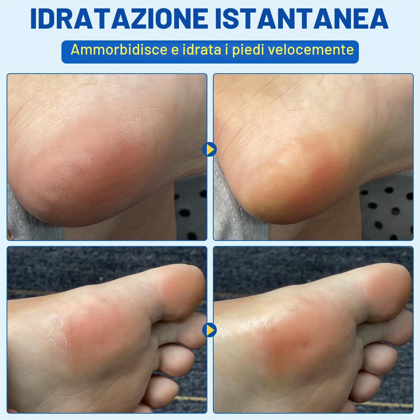 2pcs 60% Urea Stick per la cura dei piedi con acido salicilico al 2%, per talloni secchi screpolati e pelle ispessita,80g