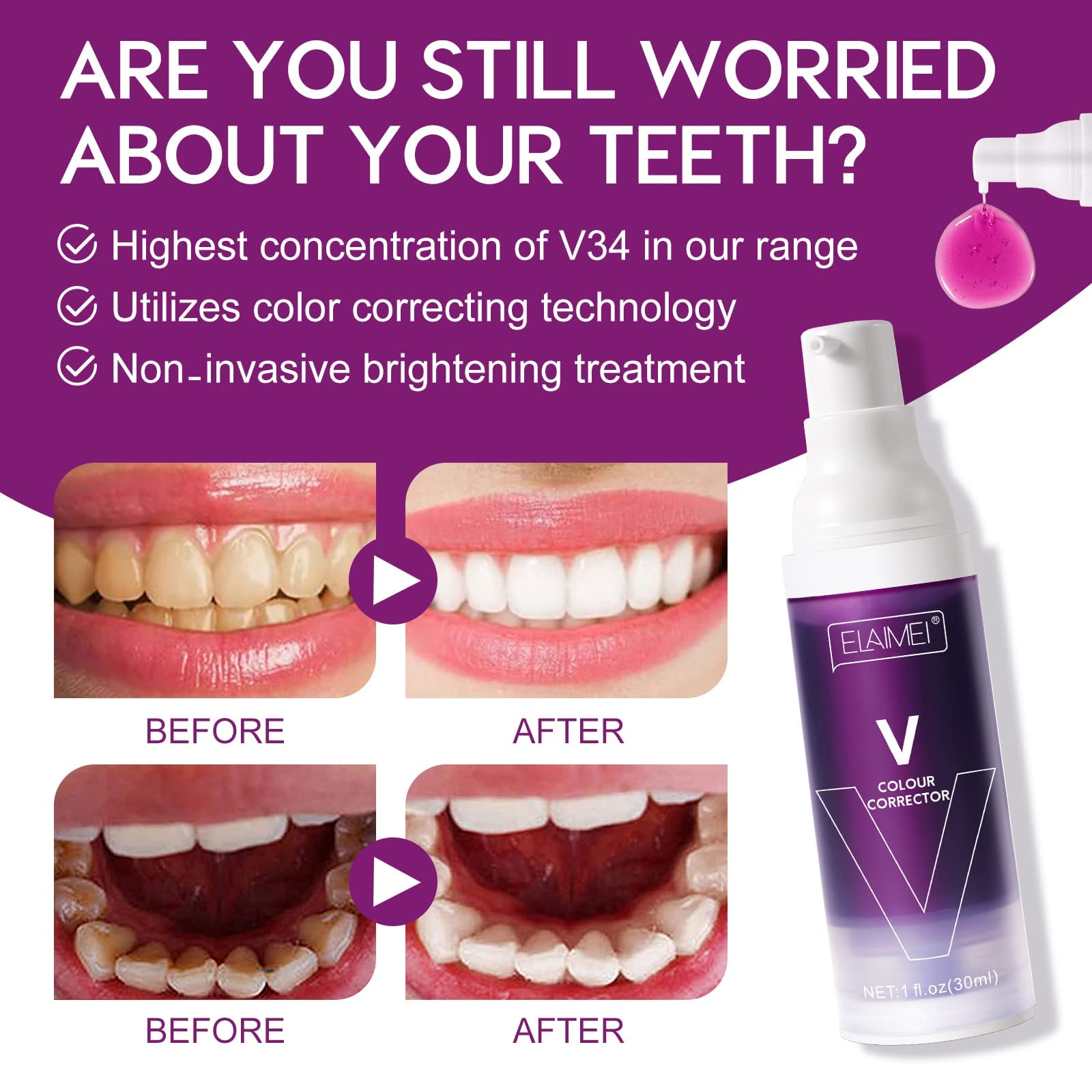 blanqueador dental v 34 blanqueador dental - blanqueamiento de dientes V 34 Purple Teeth Whitening, Tooth Colour Corrector, teeth whitening