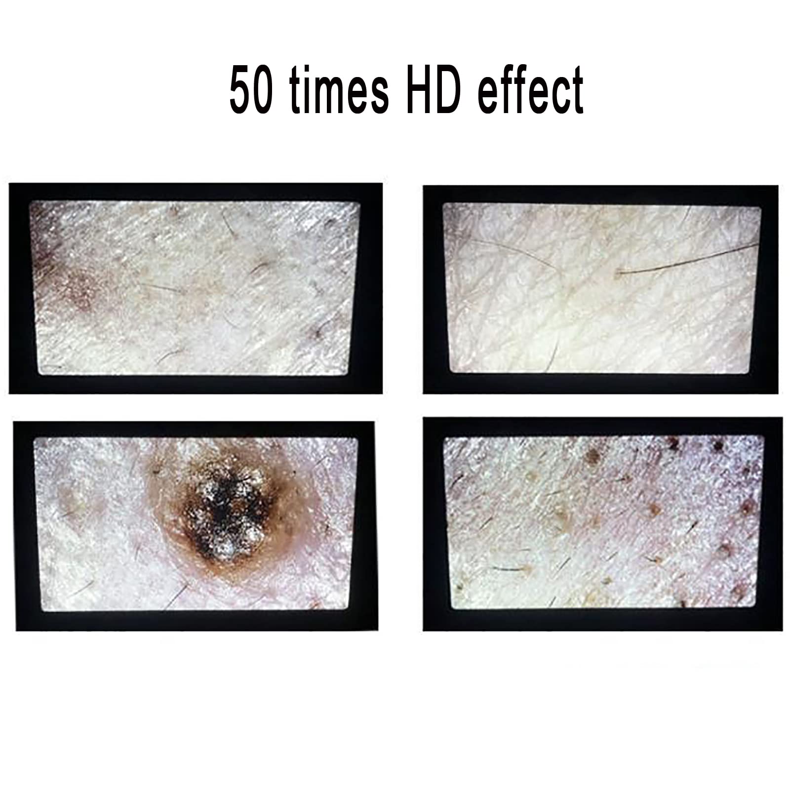 Analizzatore di capelli per diagnosi della pelle, scanner digitale per diagnosi della pelle con schermo LCD da 5 pollici, macchina per analizzatori di capelli ricaricabile 50X 200X, per casa, salone