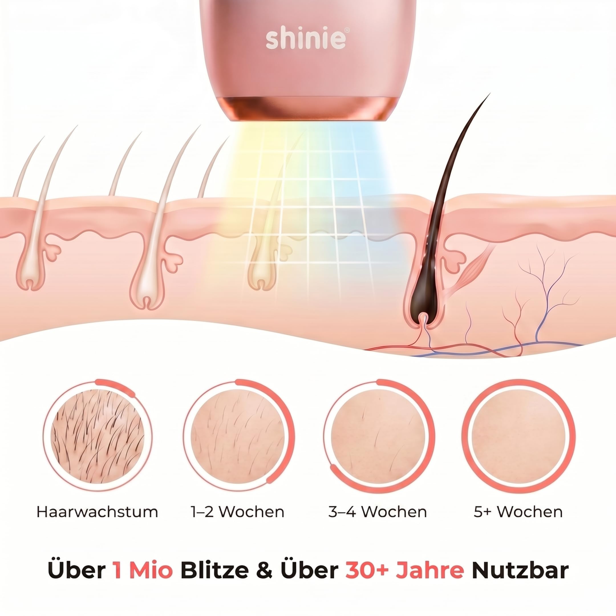 shinie Smart IPL Gerät Haarentfernung 2.0 — Professionelle Dauerhafte und Schmerzfreie Laser Haarentfernung für Zuhause, IPL Technologie — Inkl. Schutzbrille, Rasierer
