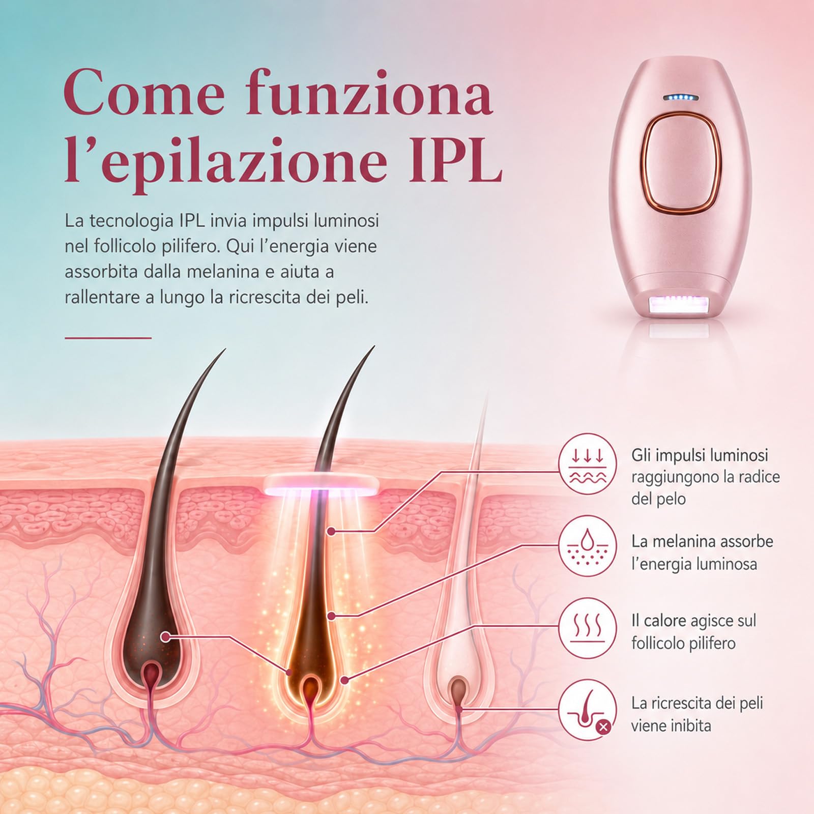 Solippy Luce Pulsata, Loop Solippy Epilatore Laser IPL, Epilatore a Luce Pulsata con 5 Intensità, Modalità Auto e Manuale, per Gambe, Braccia, Ascelle e Zona Bikini (Rosa)