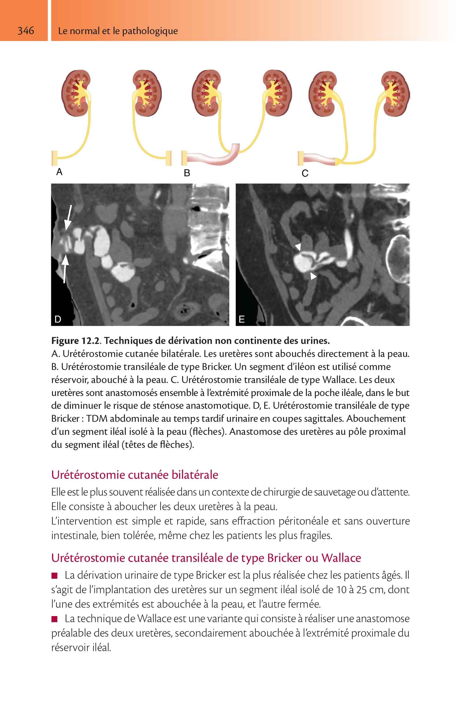 Imagerie de l'appareil urinaire de l'adulte