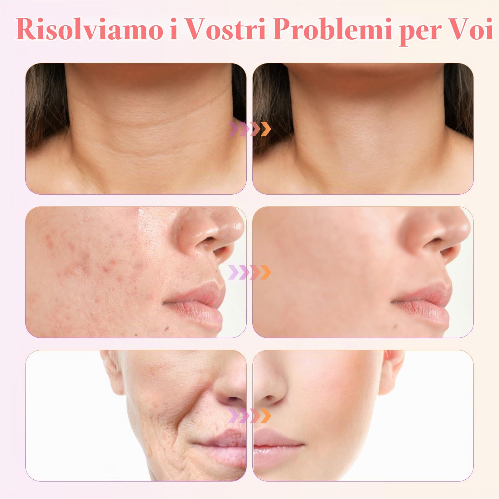 Alta Frequenza Viso, iklestar Macchina Facciale ad Alta Frequenza di per la crescita dei Capelli con 6 Tubi di Vetro, Kit di Bacchette palmari ad Alta Frequenza per uso Domestico