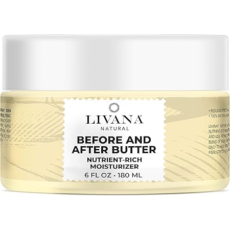 joy ointment for stretch marks