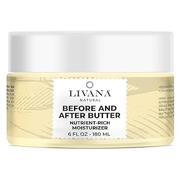 joy ointment for stretch marks