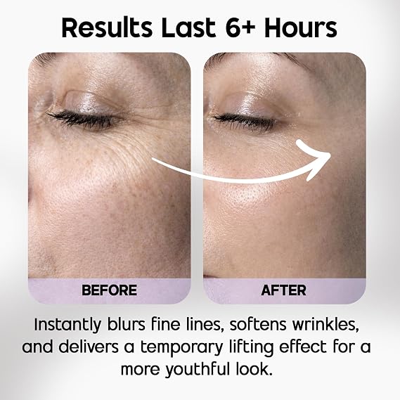 Venofye Blossom Bee Advanced Wrinkle Corrector - Instant Wrinkle Filler with Bee Venom, Peptides, Hyaluronic Acid - Temporary Skin Tightener - for Under Eye Bags, Forehead and Mouth Lines - 0.53 Oz