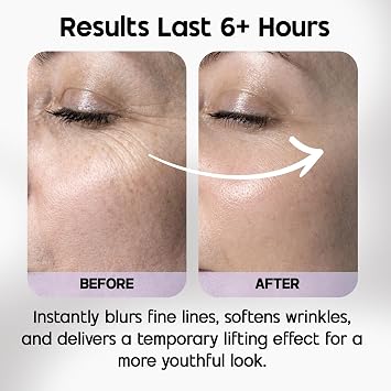 Venofye Blossom Bee Advanced Wrinkle Corrector - Instant Wrinkle Filler with Bee Venom, Peptides, Hyaluronic Acid - Temporary Skin Tightener - for Under Eye Bags, Forehead and Mouth Lines - 0.53 Oz