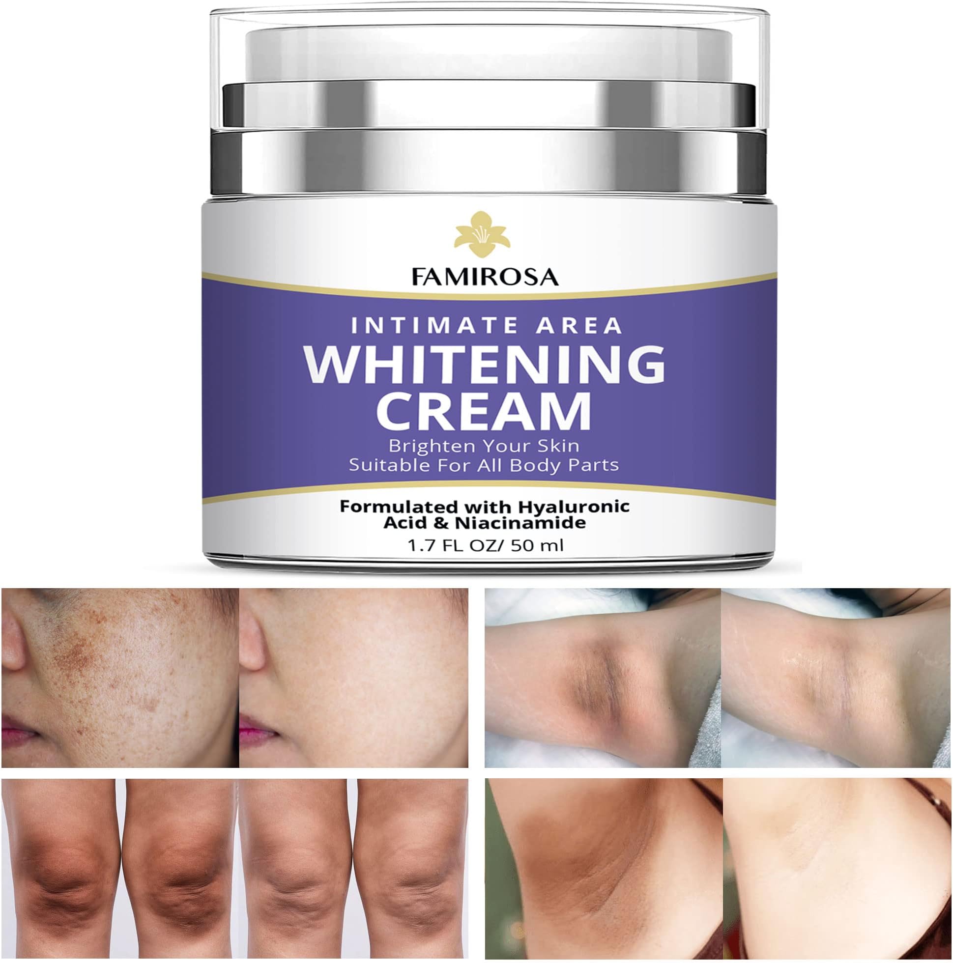 Intimate Area Dark Spot Corrector: Underarm Cream for Armpit, Knees, Elbows, inner Thigh, Private Parts - Intimate Skin Cream 50 ml