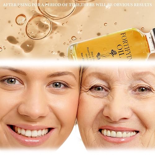 Miniatura 4 de Lalena - Aceite de rosa mosqueta, aceite fortificante, aceite de ricino, aceite de semilla negra, aceite de rosa mosqueta, aceite de ricino lilinas,