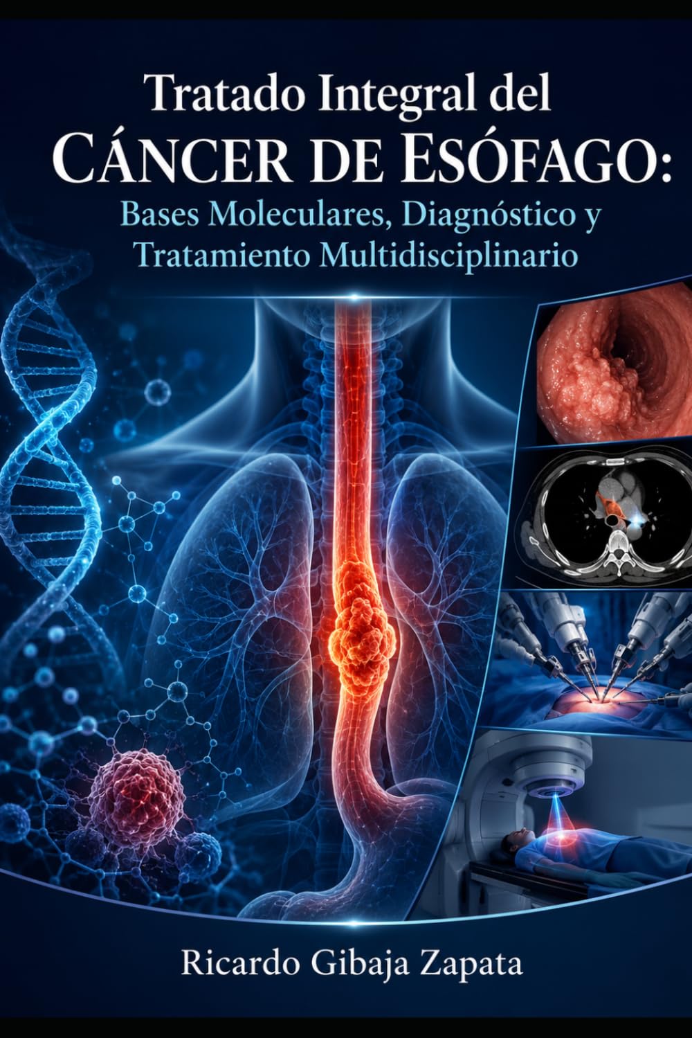 Tratado Integral del Cáncer de Esófago: Bases Moleculares, Diagnóstico y Tratamiento Multidisciplinario