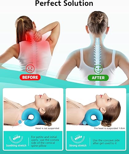 Miniatura 5 de Relajante de cuello y hombros, dispositivo de tracción cervical para aliviar la fatiga y el dolor de cuello y hombros, almohada quiropráctica para