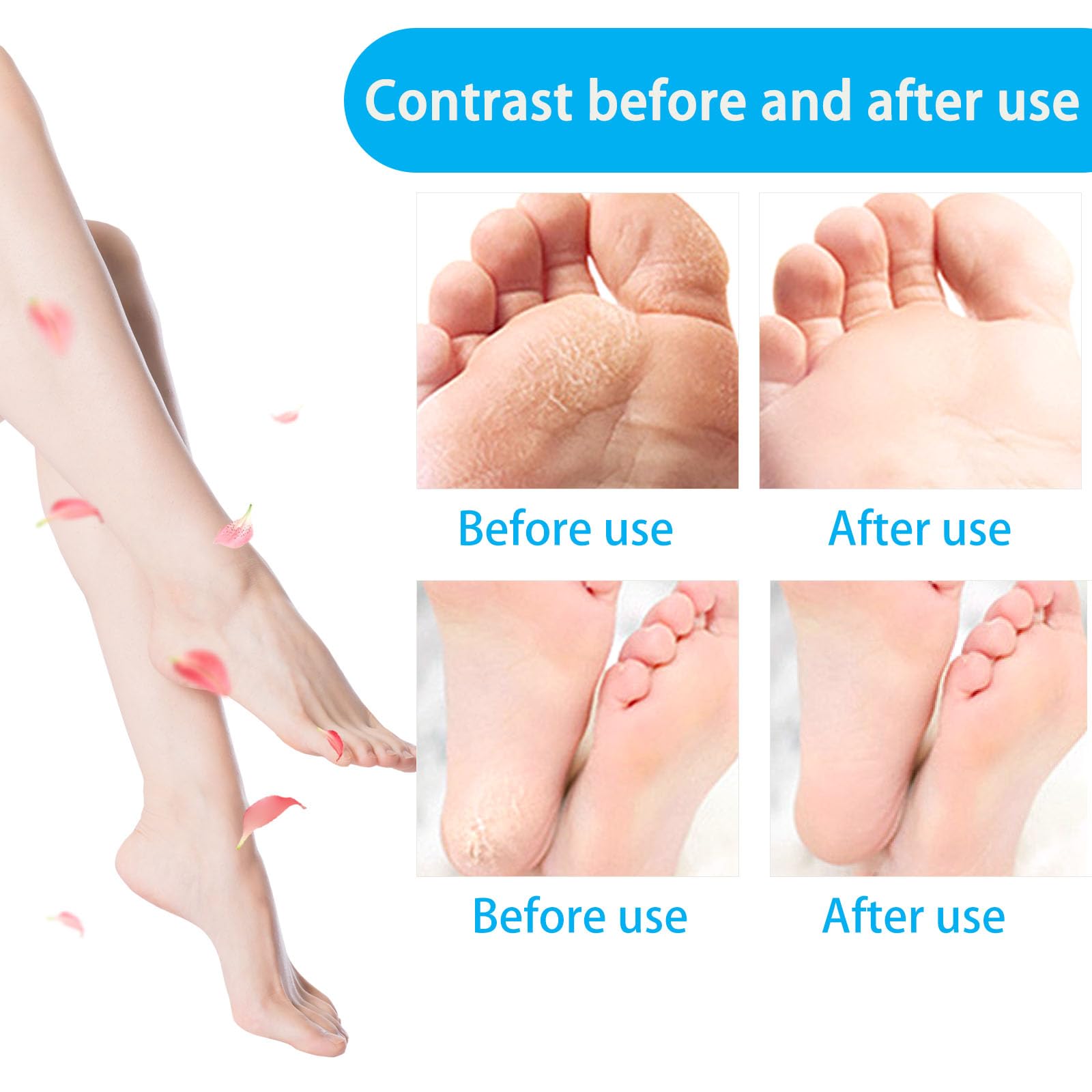 Rullo Ricambio Compatibile con Scholl Velvet Smooth, Roll Ricariche Professionale per Pedicure Elettrico, 3 Tipi di Rugosità, Pietra Pomice per Piedi, Raspa Piedi, Esfoliante, Togli Calli