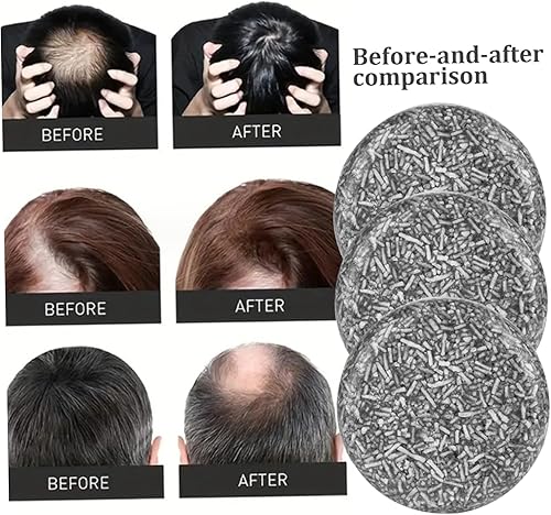 Miniatura 3 de Jabón negro para cabello gris, barra de champú de 3 piezas, barra de champú para oscurecer el cabello para mujeres y hombres, jabón natural para