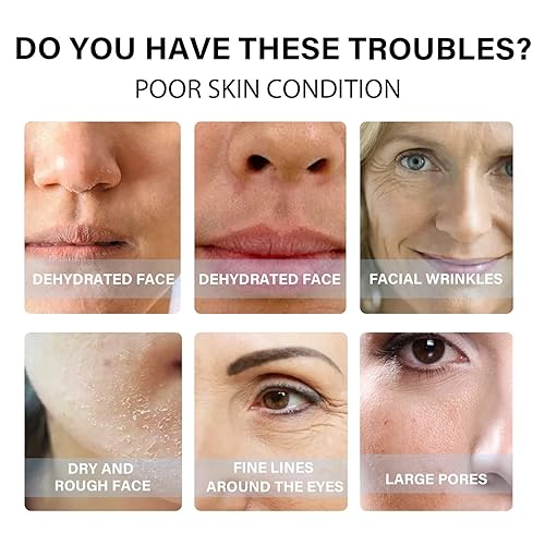 Miniatura 8 de Hilos Tensores Para El Rostro Invisibles Hilos De Colageno Absorbibles Para La Cara, Glicerina Para La Piel, Hilos De Colageno Hilos Para El Rostro