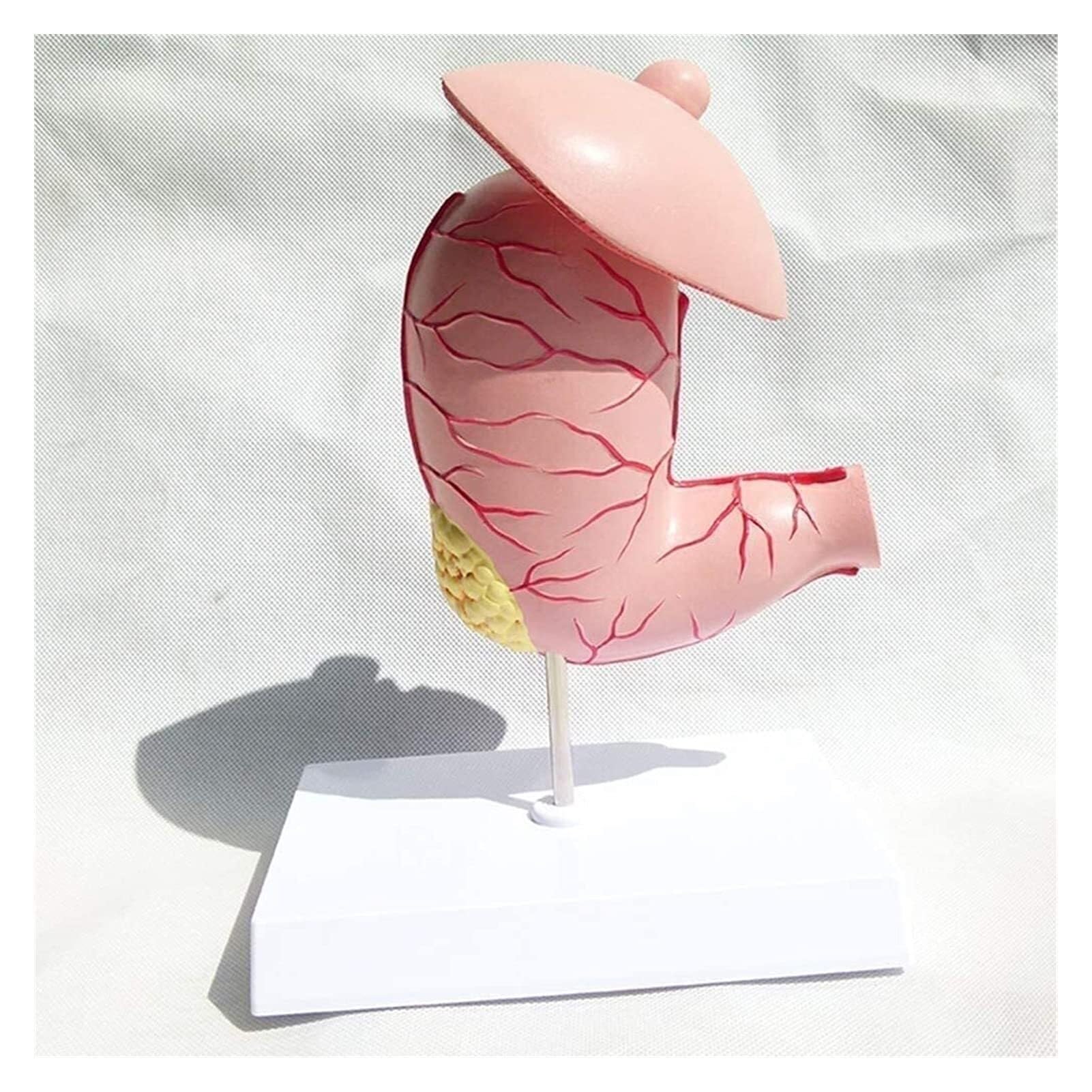 XINGLUOY Stomach disease anatomical model, human stomach, digestive system medical