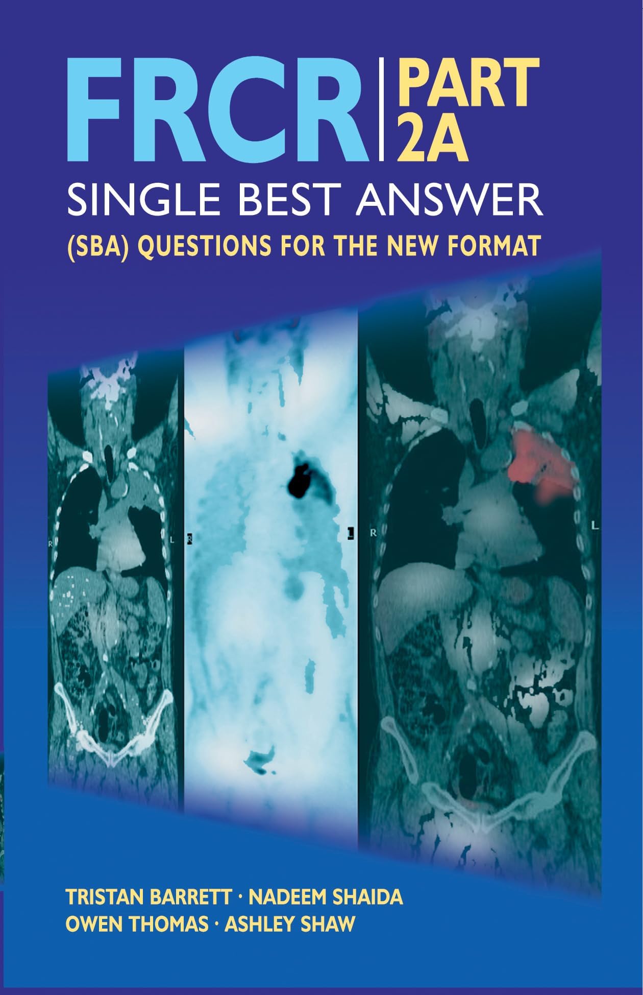 Frcr Part 2a: Single Best Answer (Sba) Questions for the New Format
