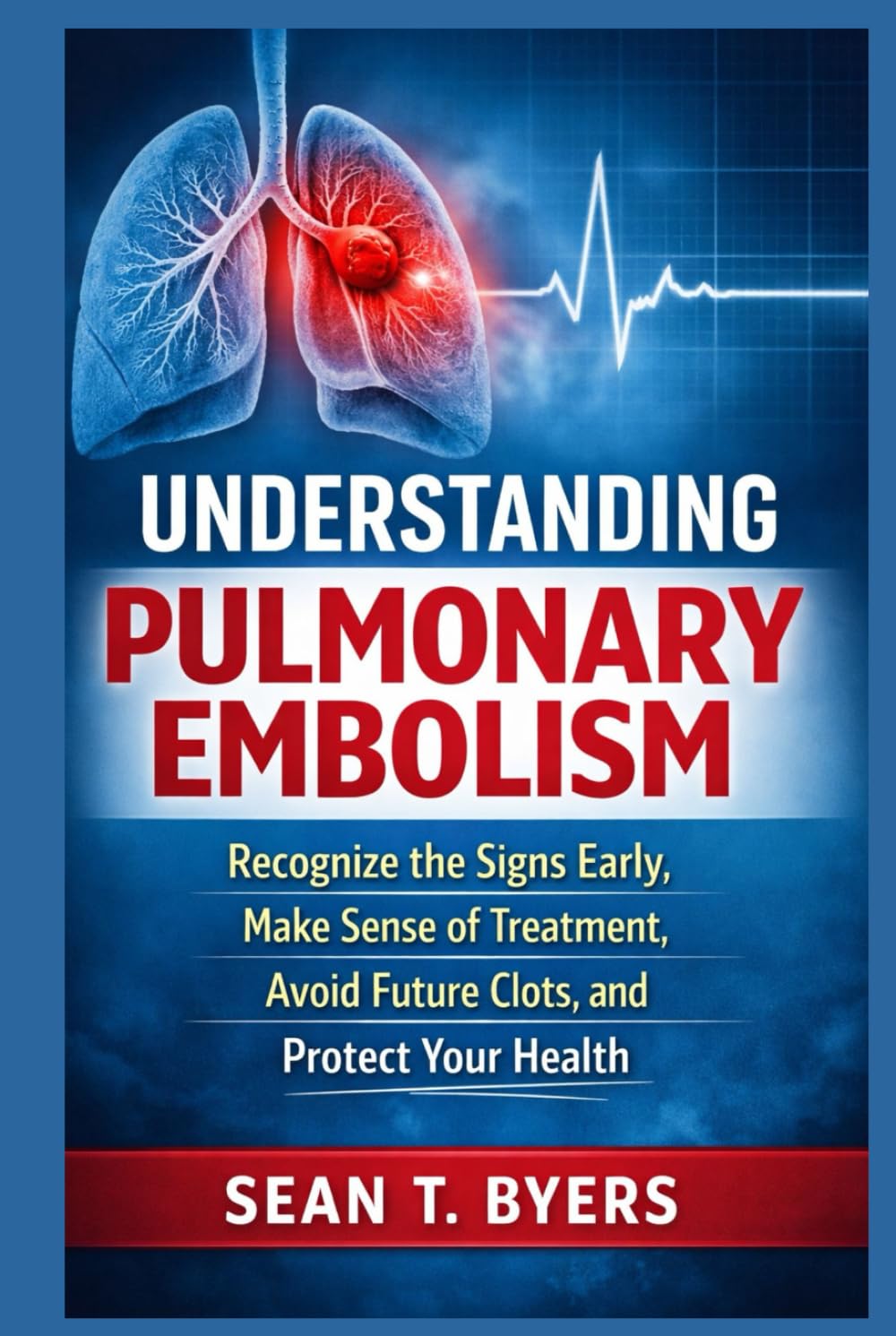Understanding Pulmonary Embolism: Recognize the Signs Early, Make Sense of Treatment, Avoid Future Clots, and Protect Your Health
