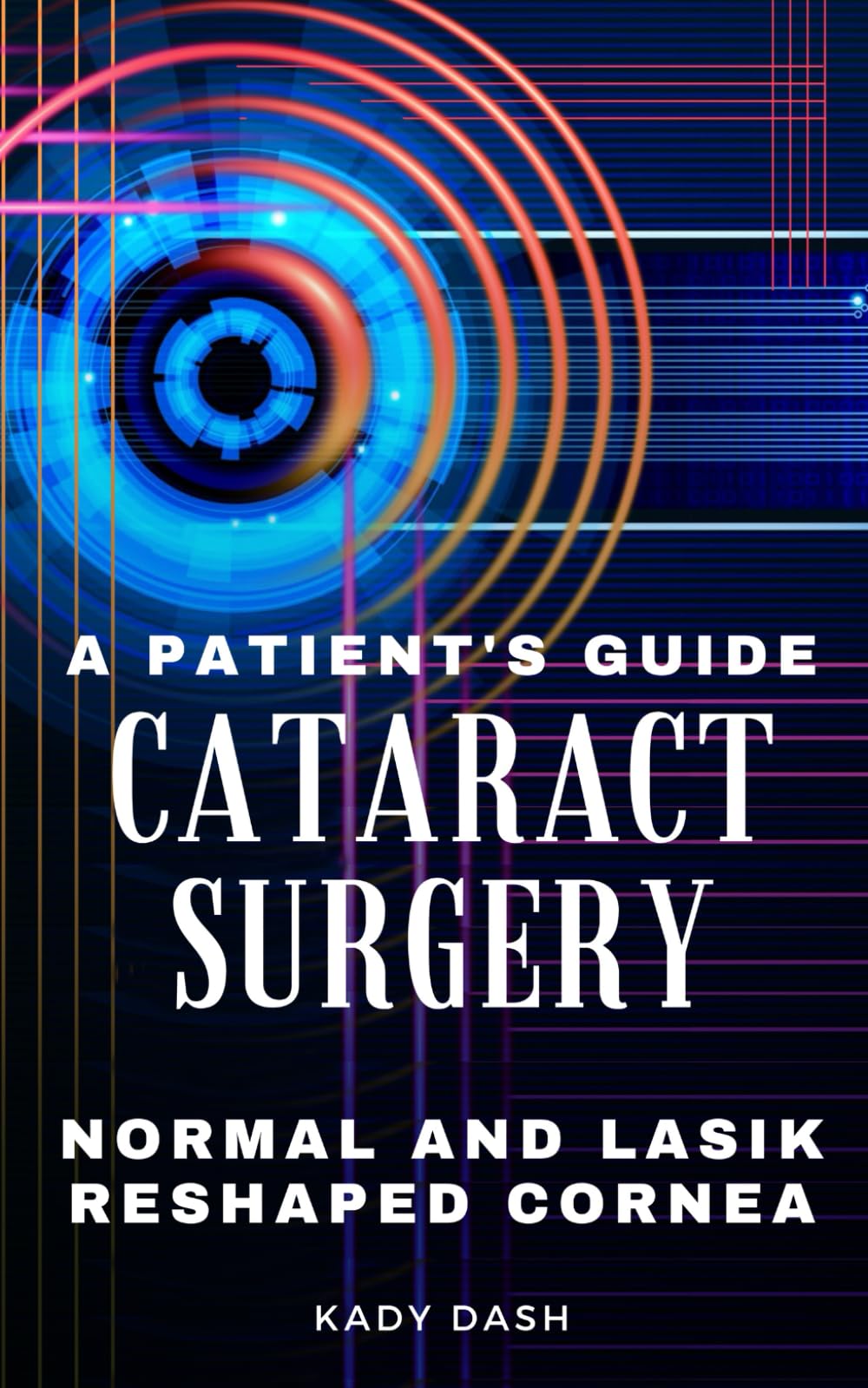 A Patient's Guide to Cataract Surgery: Normal and LASIK Reshaped Cornea