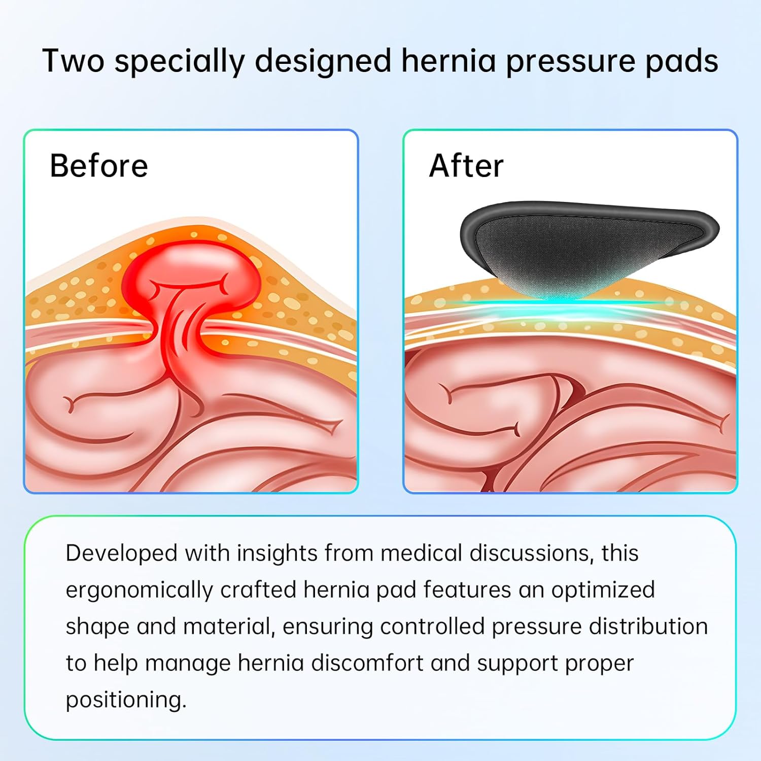 Hernia Belt for Men - Adjustable Support Brace, Comfortable & Breathable Design, Ideal for Single/Double Inguinal Hernia Pain Relief, Discreet Wear for Everyday Use (Black, Medium)