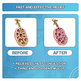 Safrel Pharma Mucus Relief Guaifenesin 400 mg - Fast Acting Expectorant, Thins and Loosens Mucus, Relieves Chest Congestion, Cough, Cold and Flu (500 Count (Pack of 1))