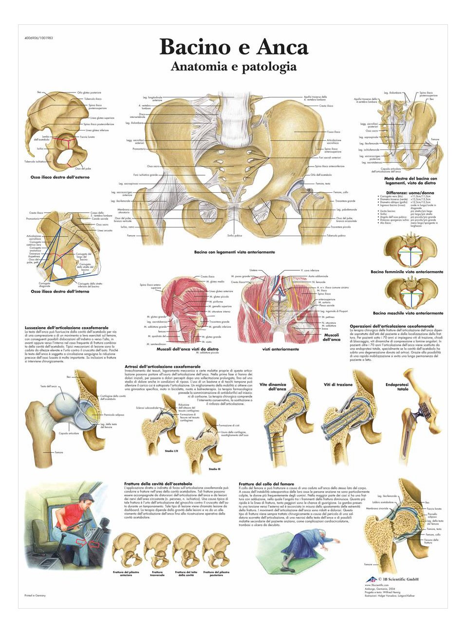 3B Scientific vr4172l Pelvis and Hip, Anatomy and Pathology, 1