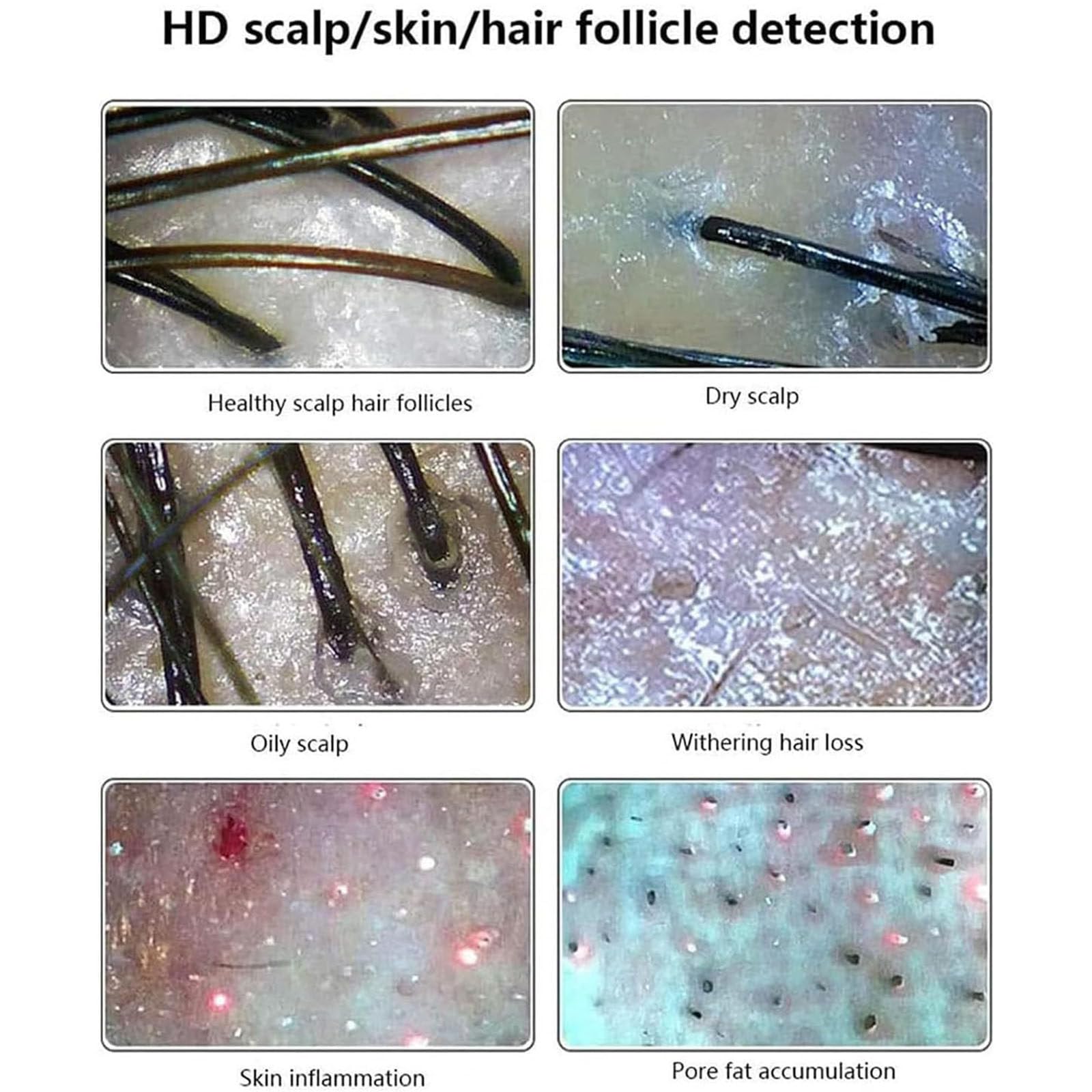 Analizzatore Capelli E Pelle Microscopio Digitale LCD 11 in Portatile per Rilevatore Cuoio Capelluto,Rilevatore di umidità Olio per Follicoli Piliferi Tester per Pigmenti Pelle