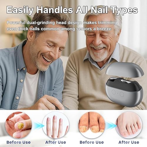 Miniatura 3 de Fanyil Easyclip - Cortauñas inteligente  Cortauñas eléctrico para personas mayores, cortauñas automático 3 en 1 con pulido y luz LED, recargable por