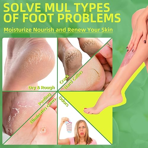 Vista 2 de Exfoliante de pies, exfoliante de azúcar, removedor de piel muerta para pies, exfoliante de pies empaquetado individualmente suaviza, hidrata