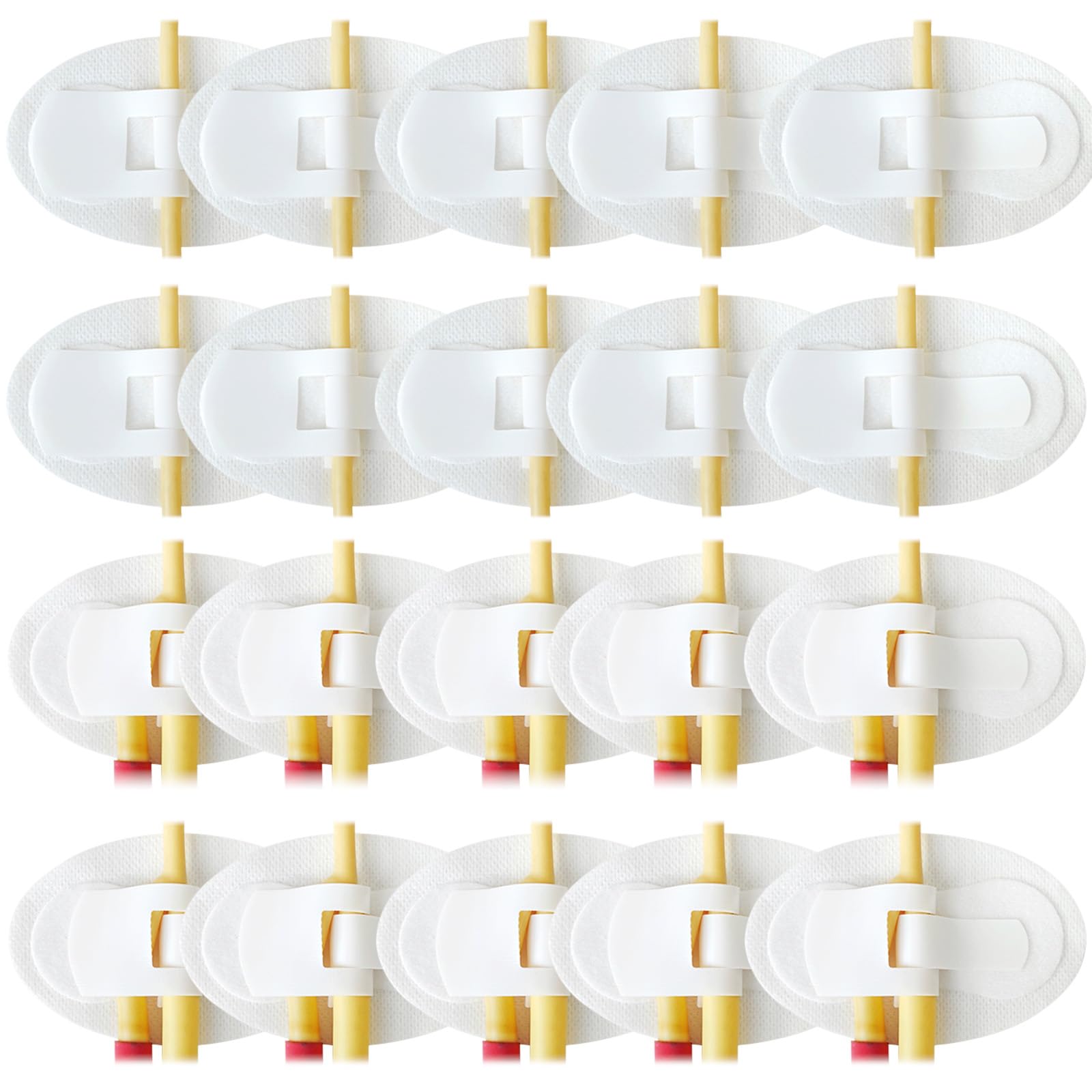 Foley Catheter Stabilization Device 20Pcs Urinary Leg Bag Legband Catheter Tube Holder Adhesive Catheter Securement Device Urinary Catheter Hook and Loop Fixing Device Accessories