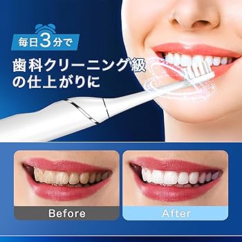 キュラソニック 電動 歯ブラシ 口臭予防 オーラルケア 電動歯ブラシ USB 楽天市場】【公式】 キュラソニック 電動 歯ブラシ 口臭予防
