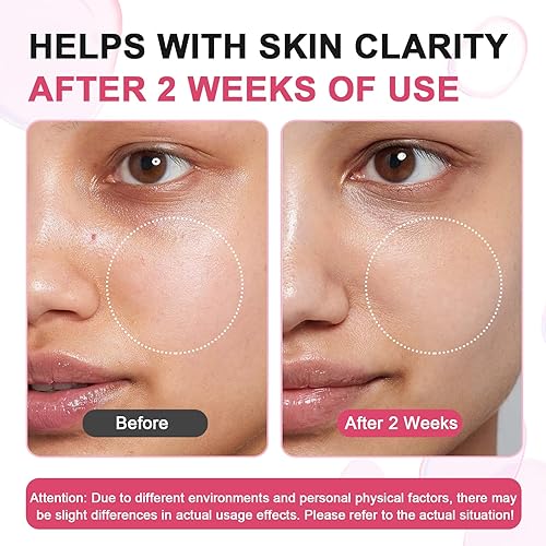 Miniatura 4 de SUDAJI TXA + niacinamida 15% (1.76 fl oz) Suero facial brillante, ácido hialurónico, ácido tranexámico, vitamina B12, suero facial para tono de piel