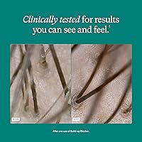 Vista 4 de Nutrafol Máscara Exfoliante para el Cuero Cabelludo, Elimina la Acumulación de Productos y el Aceite para un Cabello y Cuero Cabelludo Más