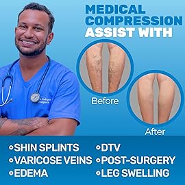 Extra Wide Compression Stockings for Men and Women 20-30mmHg - Opaque Compression Thigh High for Circulation, Arthritis, Edema, Lymphedema, Swelling - Black, 5X-Large - A213BL8