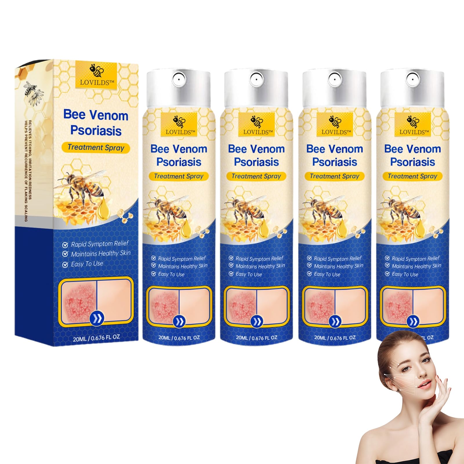 LOVILDS PsoriaHeal Bee Venom Psoriasis Treatment Spray pro - 100% Pure Natural Bee Venom Psoriasis Repair Spray, LOVILDS Bee Venom Psoriasis Skin Treatment Spray for All Skin Types (4 Pack)