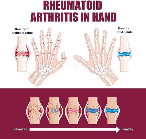 Miniatura 3 de Crema para articulaciones y huesos Perfectx, crema corporal Perfectx 2PCS