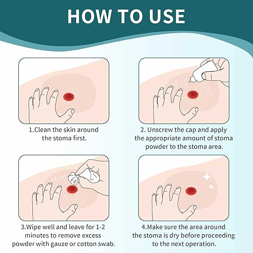 Miniatura 6 de Polvo de estoma, protección de barrera cutánea, suministros de polvo de ostomía, polvo adhesivo para estoma, 1 onza (6 botellas)