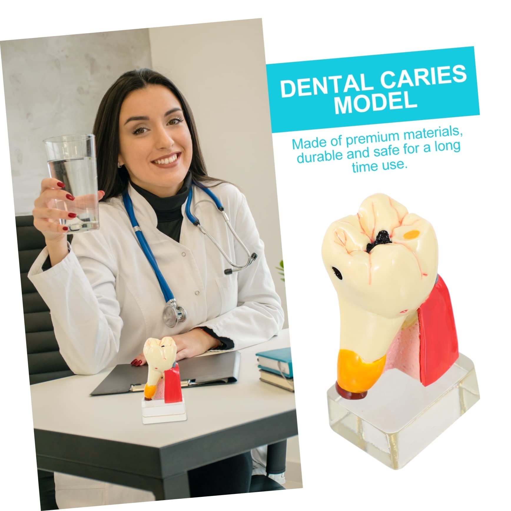 Alipis 4volte Modello di Carie Modello Anatomico di Carie per Studio e Ricerca Odontoiatrica Leggero e Portatile