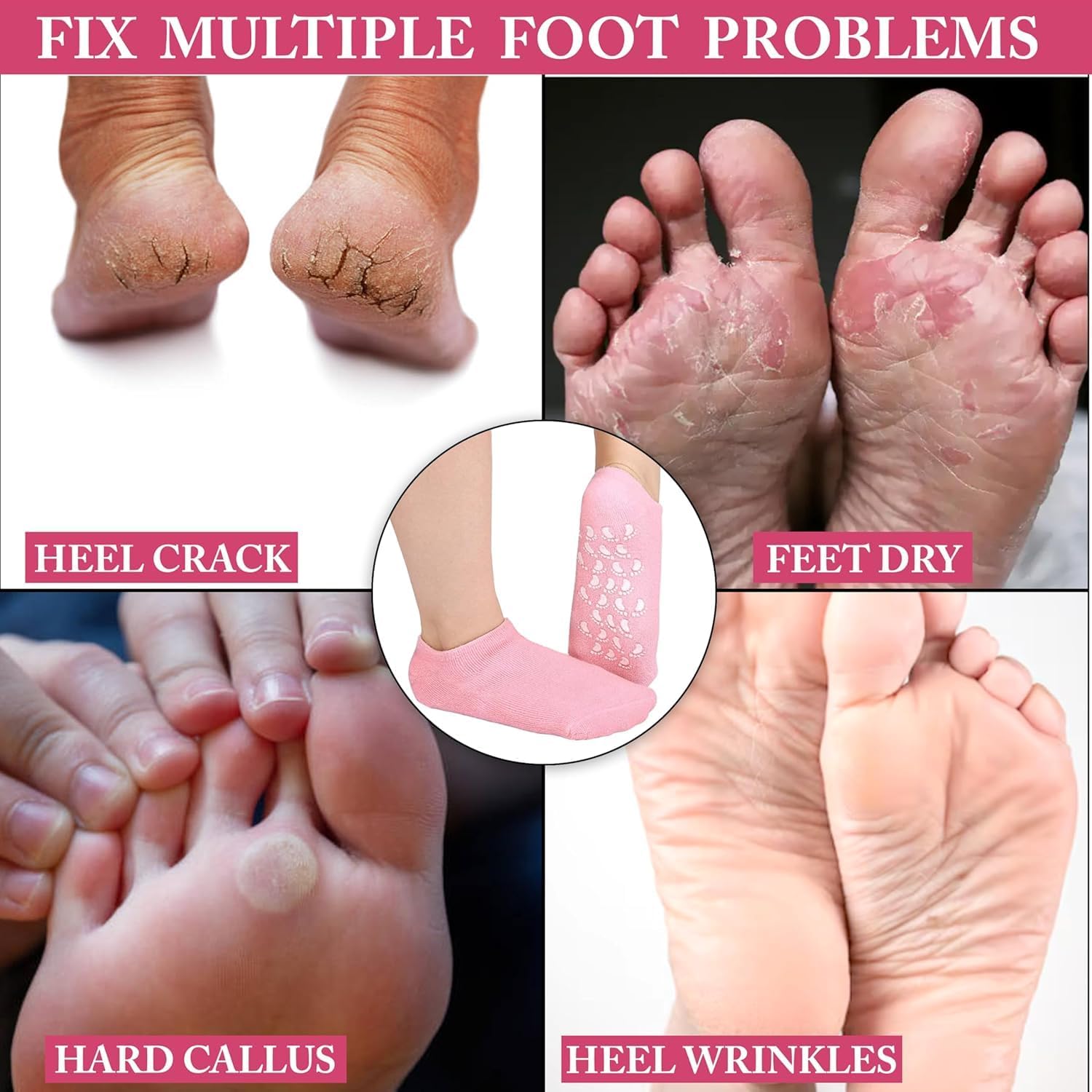 MANTHUMI Anti Crack Half-Length Silicone Foot Protector Moisturizing Silicone Socks Suitable for Men & Women Foot-Care, Heel Cracks and Heel Pain (Multicolor, Pair of 1) 2
